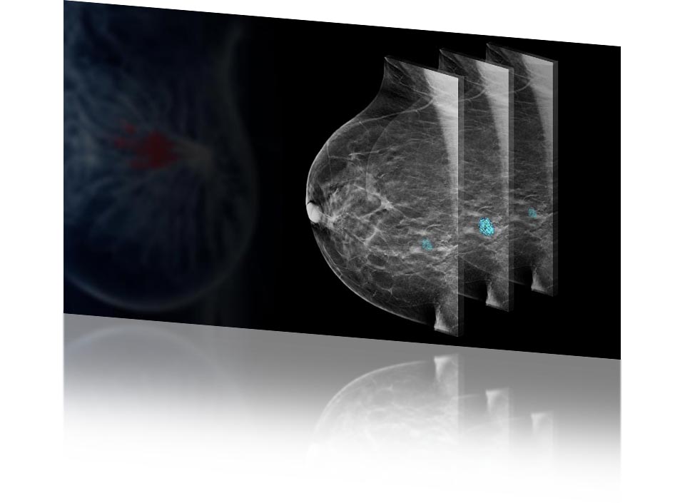 complete digital mammography system optimized for 3D tomosynthesis